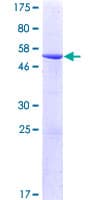 Human AK4 / Adenylate Kinase 4 Protein (Recombinant GST)