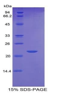 Mouse CSF3R / CD114 Protein (Recombinant His)