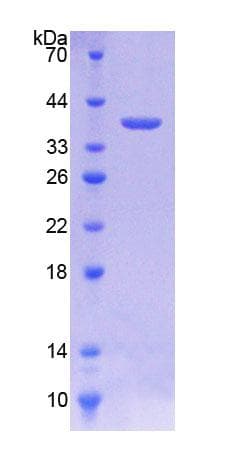 Human DSG2 / Desmoglein 2 Protein (Recombinant His-T7)