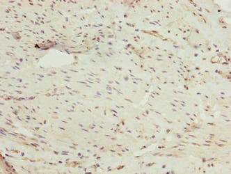PPIL4 Antibody (aa1-492)