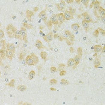 SLC37A4 / G6PT Antibody