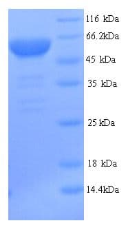 Mouse UMOD / Uromodulin Protein (Recombinant 6His, N-terminus)