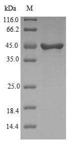Human VILIP / VSNL1 Protein (Recombinant GST, N-terminus)