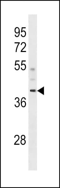 CCDC83 Antibody (aa1-30)