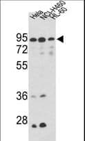 Polyclonal Rabbit anti-Human IMMT / Mitofilin Antibody (aa438-467, IHC, WB)