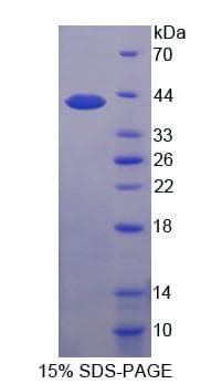 Human SLC2A4 / GLUT-4 Protein (Recombinant His-GST, N-terminus)