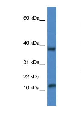 VAMP1 / VAMP-1 Antibody (aa53-102)