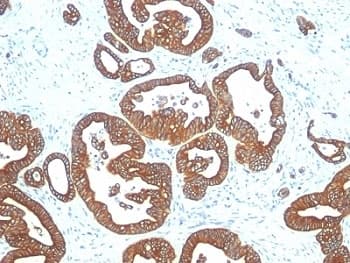 KRT18 / CK18 / Cytokeratin 18 Antibody (clone DE-K18)