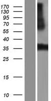 Human LRRC38 Protein (Over-Expression Lysate Myc-DDK (Flag))
