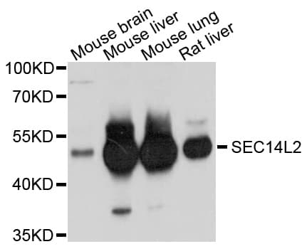 SEC14L2 Antibody