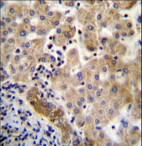 LIN7C / VELI3 Antibody (aa168-197)