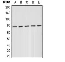 PRKCD / PKC-Delta Antibody (phospho-Tyr52)