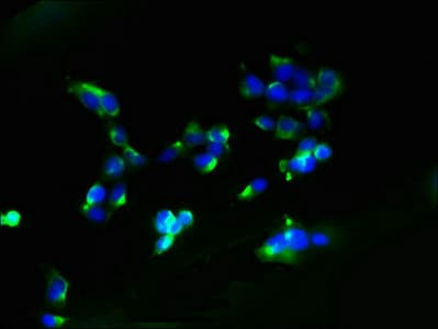 Polyclonal Rabbit anti-Human AGTRAP / ATRAP Antibody (IF)