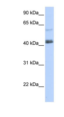 PRDM15 Antibody (aa1405-1454)