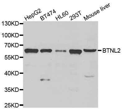 Polyclonal Rabbit anti-Human HSBLMHC1 / BTNL2 Antibody (IHC, WB)