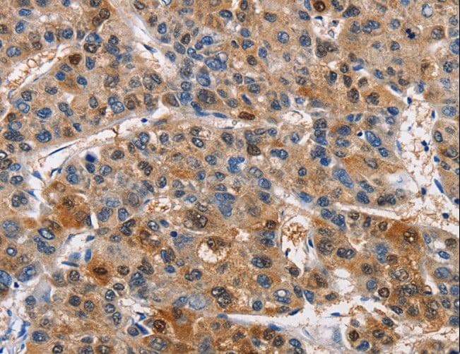PIM1 / Pim-1 Antibody