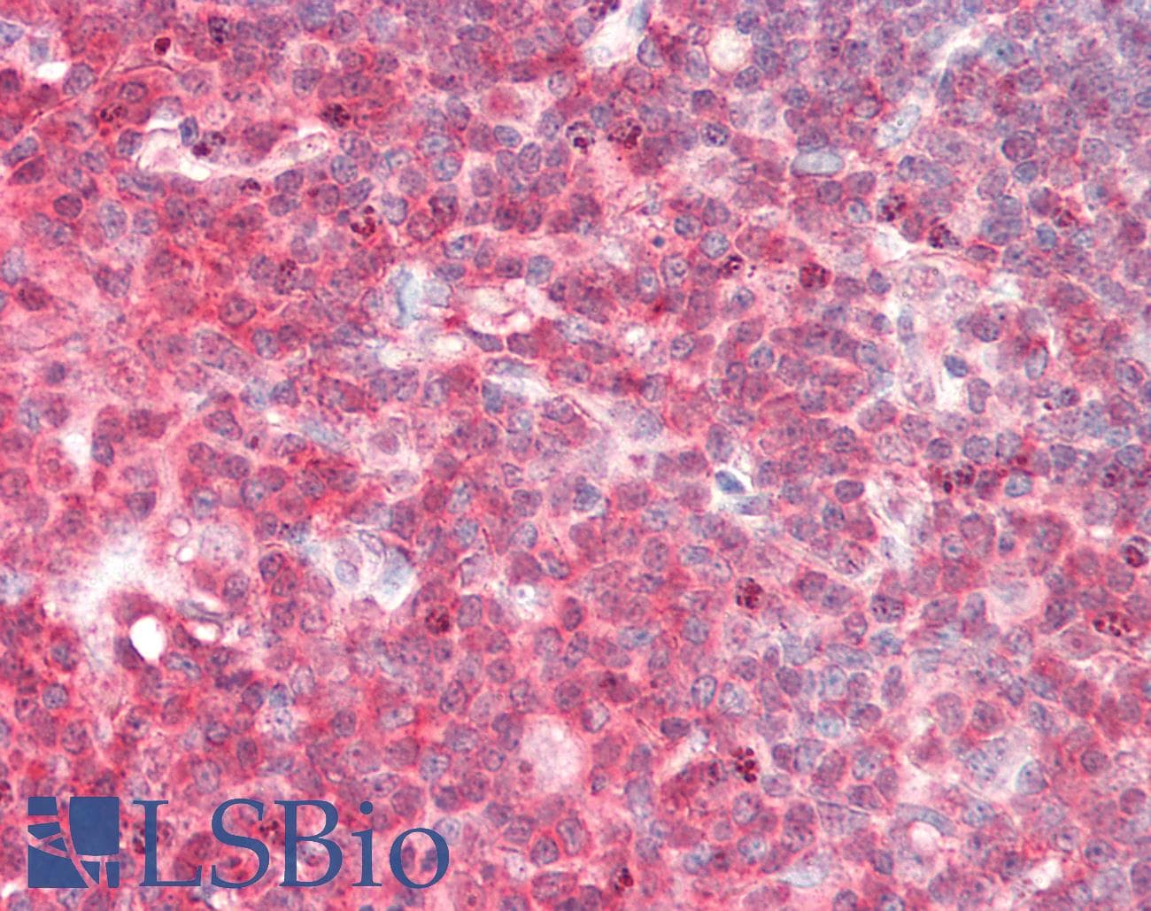 Polyclonal Rabbit anti-Human ADA / Adenosine Deaminase Antibody (aa288-337, IHC, WB)