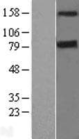 DAPK1 / DAP Kinase Protein (Over-Expression Lysate Myc-DDK (Flag))
