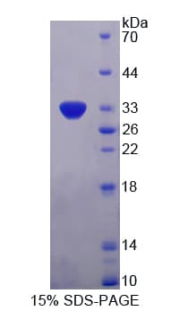 Human MPS1 / TTK Protein (Recombinant His-T7)