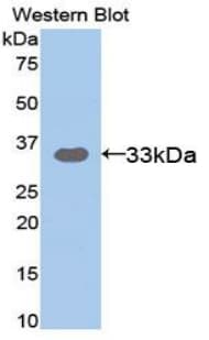 ST14 / Matriptase Antibody (aa607-852)