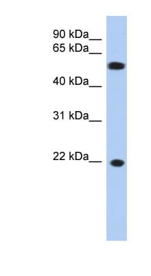 CRYGC / CCL Antibody (aa71-120)