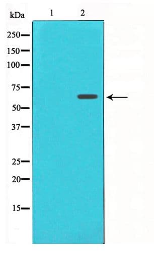 Polyclonal Rabbit anti-Human FRS2 Antibody (WB)