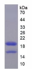 Mouse HMGIY / HMGA1 Protein (Recombinant His)