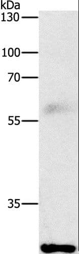 FGF2 / Basic FGF Antibody