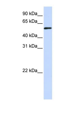 Polyclonal Rabbit anti-Human TADA3 / ADA3 Antibody (aa216-265, WB)