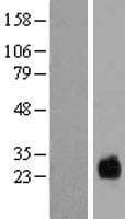 TMEM174 Protein (Over-Expression Lysate Myc-DDK (Flag))