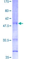 Human PTN / Pleiotrophin Protein (Recombinant GST)