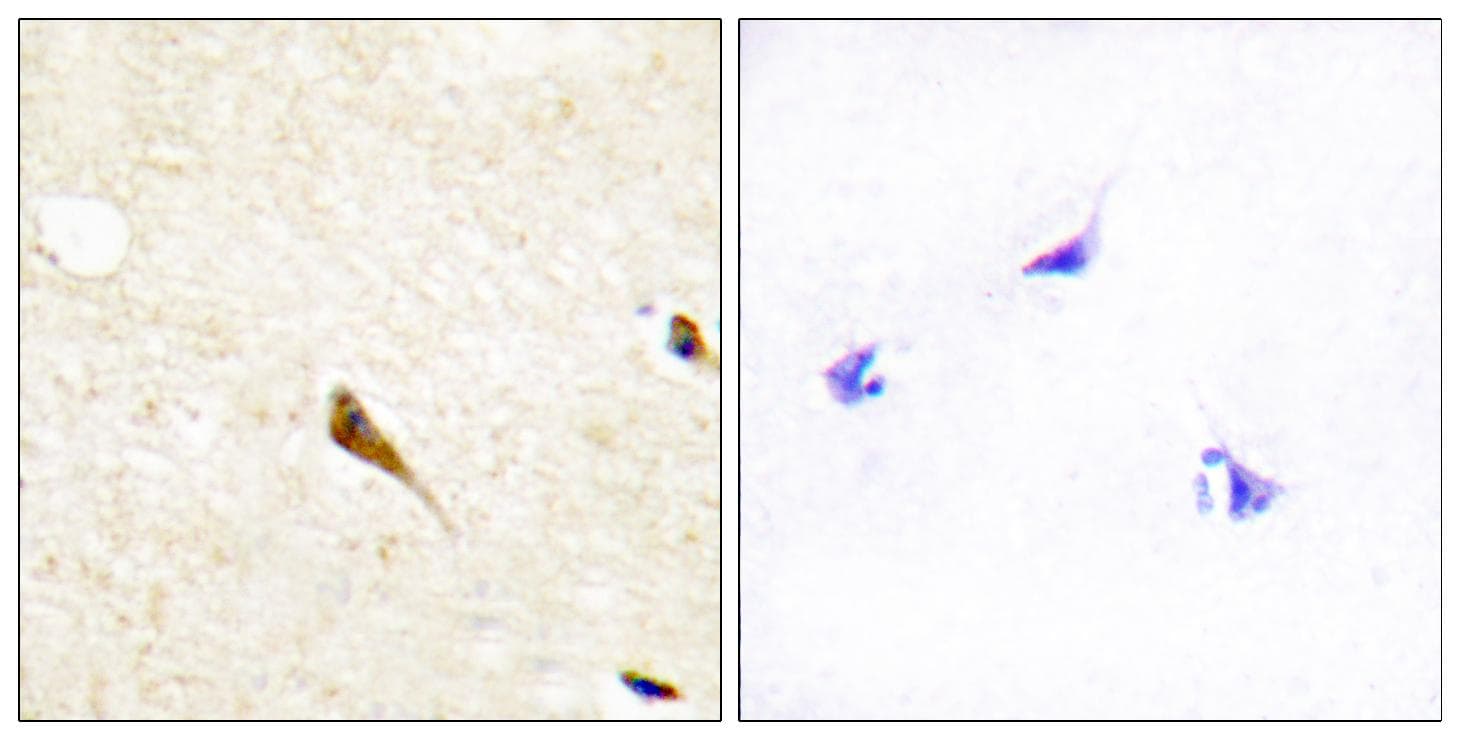 MOK / RAGE Antibody