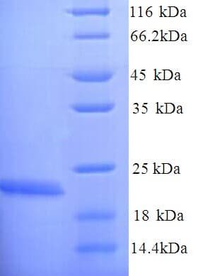 E. coli LptC Protein (Recombinant His)