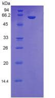 Human MBL2 / Mannose Binding Protein (Recombinant His, N-Terminal)