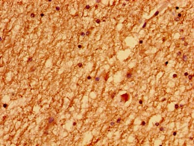 Polyclonal Rabbit anti-Human LSM1 Antibody