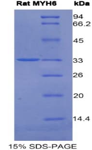 Rat MYHC / MYH6 Protein (Recombinant His)