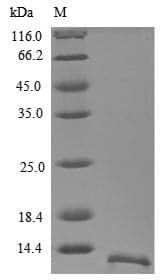 Human GYPA / CD235a / Glycophorin A Protein (Recombinant 6His, N-terminus)