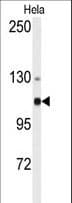 Polyclonal Rabbit anti-Human ACTN4 Antibody (aa192-220, IHC, WB)