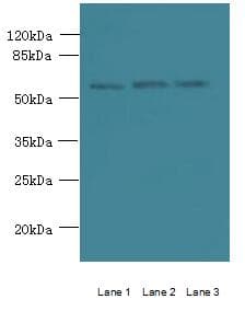 STK33 Antibody