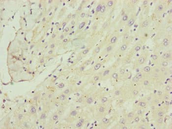 Polyclonal Rabbit anti-Human Complement C8b Antibody (aa55-350, IHC)