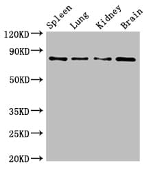 PRMT7 Antibody