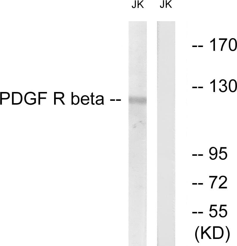 PDGFRB / PDGFR Beta Antibody (aa711-760)