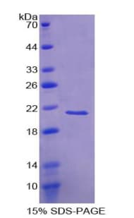 Human VILIP / VSNL1 Protein (Recombinant His-T7)