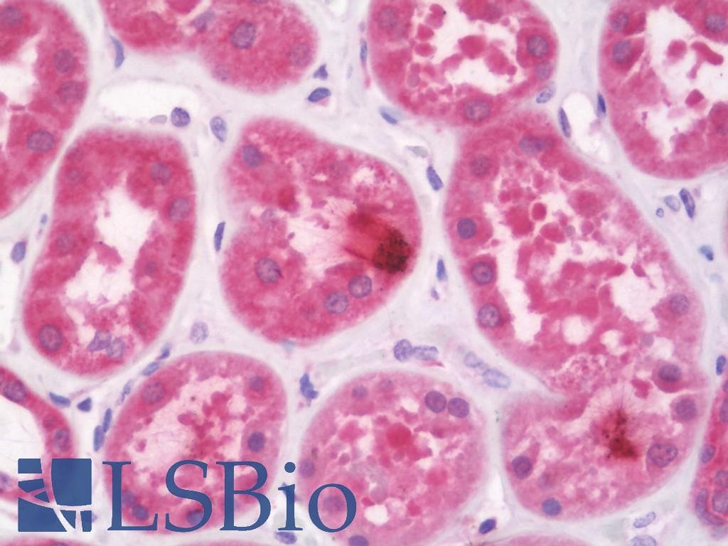 IHC-plus™ KDELR2 Antibody (aa100-150)