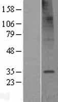 TMEM106C Protein (Over-Expression Lysate Myc-DDK (Flag))