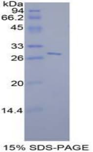 Mouse STAT6 Protein (Recombinant His, N-Terminal)