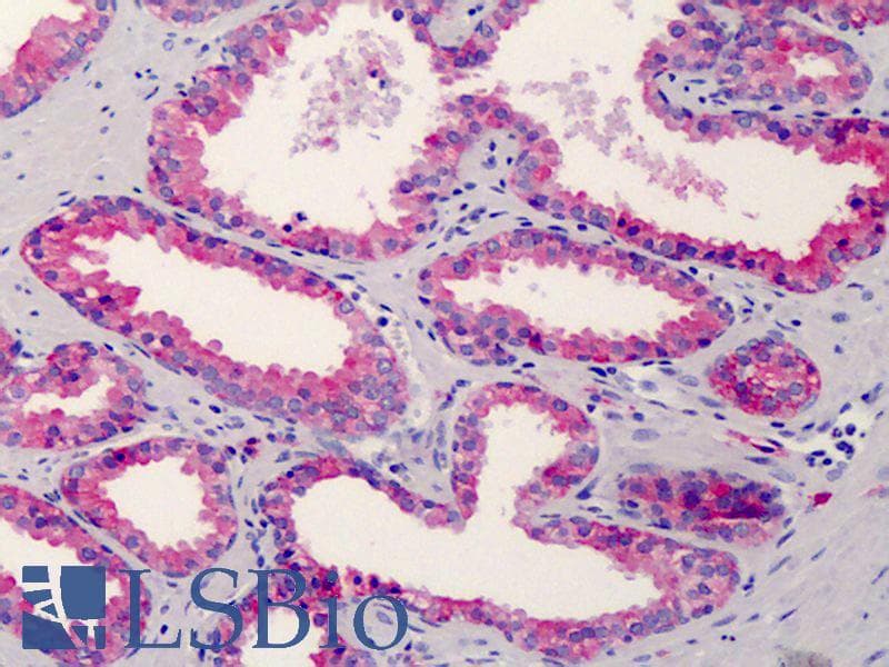 IHC-plus™ CD38 Antibody (clone HIT2)