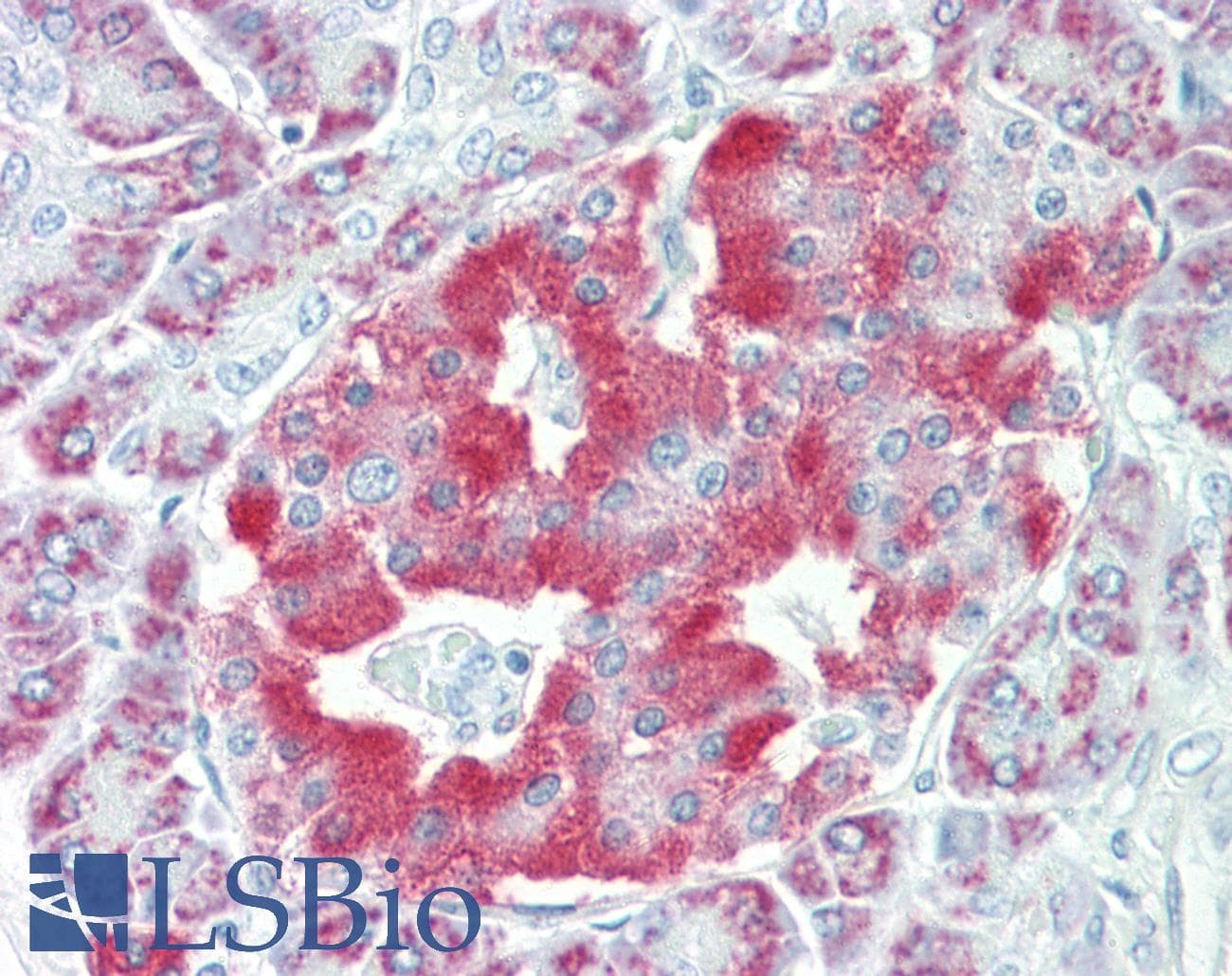 IHC-plus™ NPTX2 Antibody (aa309-338)