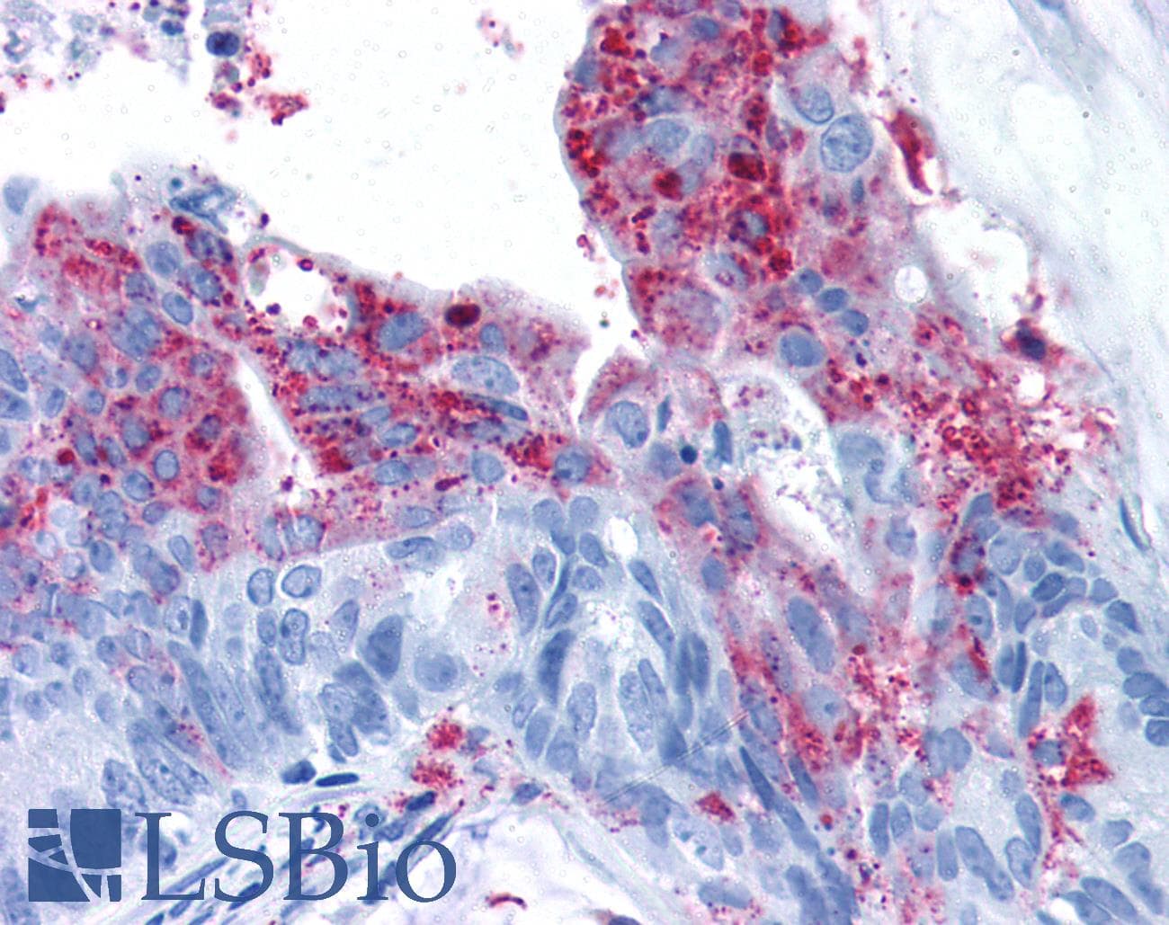 IHC-plus™ ADGRA2 / GPR124 Antibody (N-Terminus)