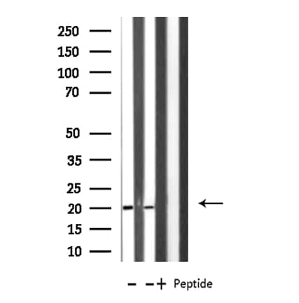 Polyclonal Rabbit anti-Human MRPL49 Antibody (IHC, IF, WB)